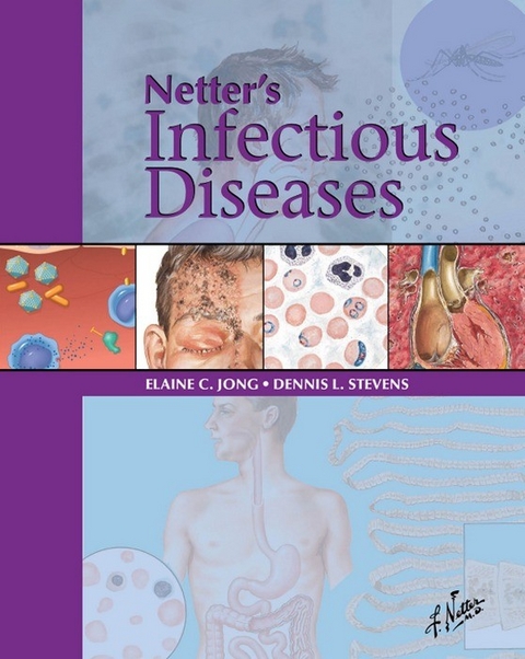 Netter's Infectious Diseases -  Elaine C. Jong,  Dennis L. Stevens