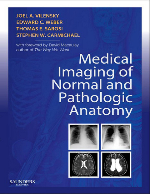 Medical Imaging of Normal and Pathologic Anatomy E-Book -  Stephen W. Carmichael,  Thomas Sarosi,  Joel A. Vilensky,  Edward C. Weber