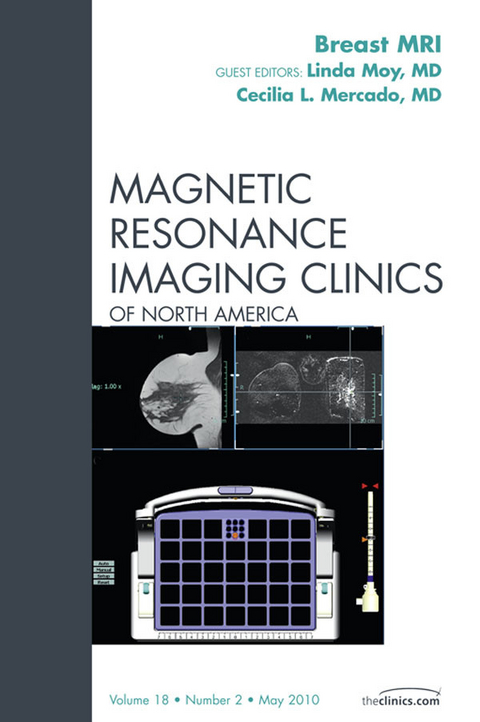 Breast MRI, An Issue of Magnetic Resonance Imaging Clinics -  Cecilia L. Mercado,  Linda Moy