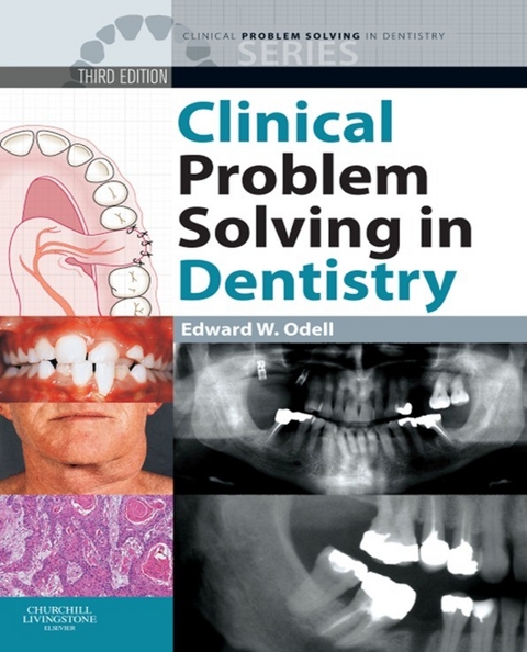 Clinical Problem Solving in Dentistry E-Book - 