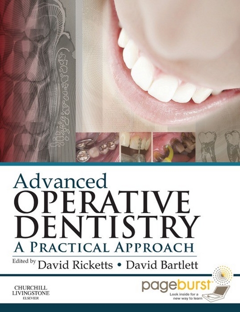 Advanced Operative Dentistry - 