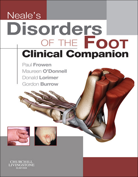 Neale's Disorders of the Foot -  Paul Frowen,  Maureen O'Donnell,  J. Gordon Burrow