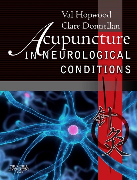 Acupuncture in Neurological Conditions -  Clare Donnellan,  Val Hopwood