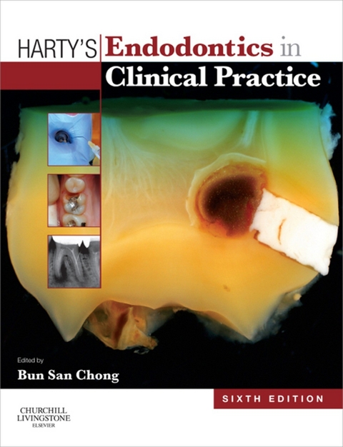 Harty's Endodontics in Clinical Practice - 