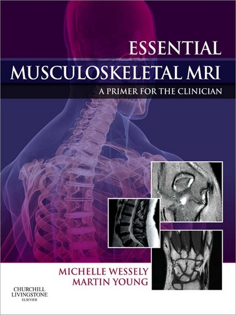 Essential Musculoskeletal MRI E-Book -  Michelle Anna Wessely,  Martin Ferrier Young