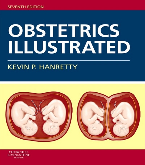 Obstetrics Illustrated -  Kevin P. Hanretty