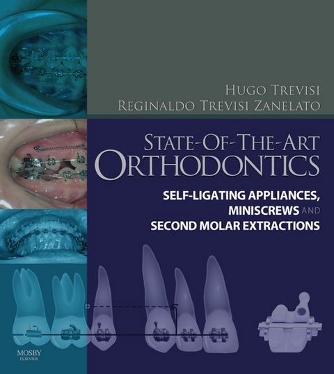 State-of-the-Art Orthodontics E-Book -  Hugo Trevisi,  Reginaldo C. Trevisi Zanelato
