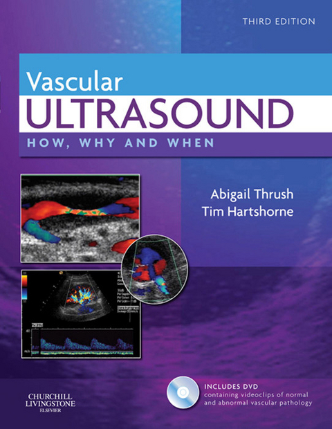 Vascular Ultrasound -  Abigail Thrush,  Timothy Hartshorne