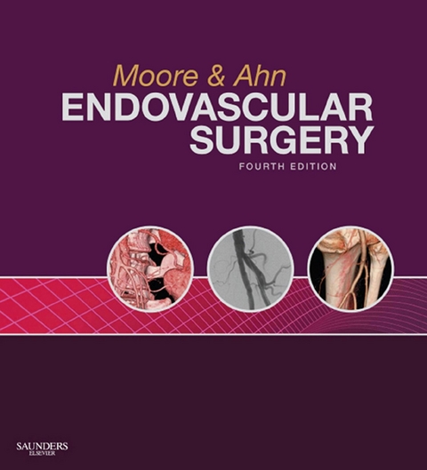 Endovascular Surgery -  Wesley S. Moore