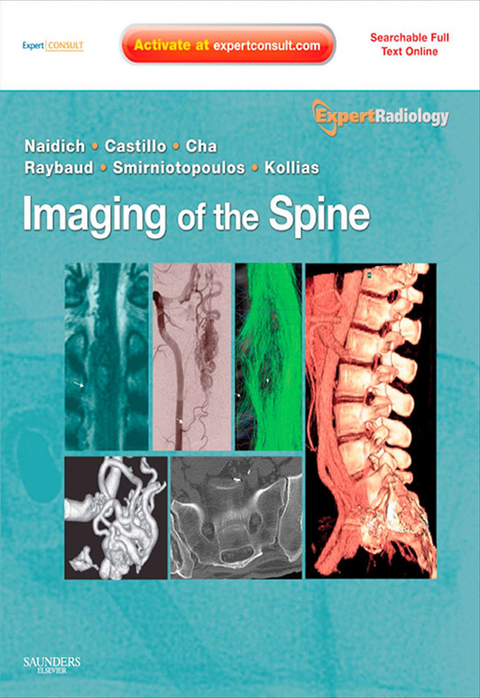 Imaging of the Spine E-Book -  Mauricio Castillo,  Soonmee Cha,  Spyros Kollias,  Thomas P. Naidich,  Charles Raybaud,  James G. Smirniotopoulos