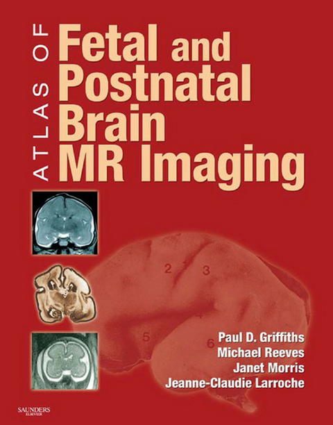 Atlas of Fetal and Postnatal Brain MR -  Paul D. Griffiths,  Jeanne-Claudie Larroche,  Janet Morris,  Michael Reeves