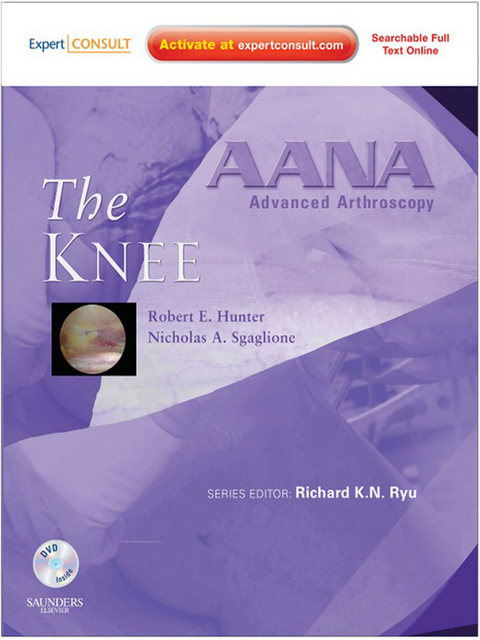 AANA Advanced Arthroscopy: The Knee -  Robert E. Hunter,  Nicholas A. Sgaglione