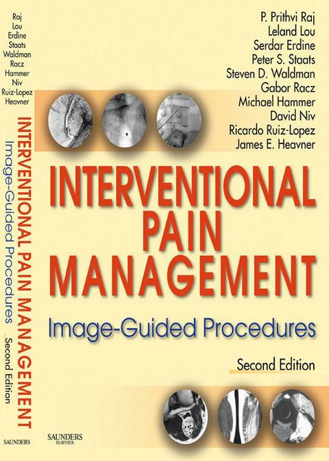 Interventional Pain Management: Image-Guided Procedures -  P. Prithvi Raj,  Leland Lou,  Serdar Erdine,  Peter S. Staats,  Steven D. Waldman,  Gabor Racz,  Michael H