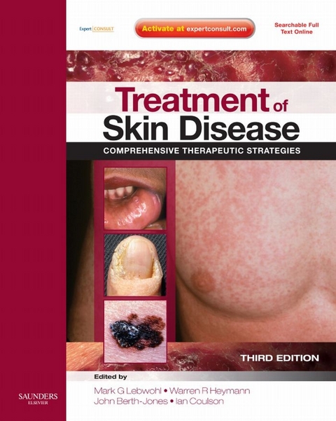 Treatment of Skin Disease -  Mark G. Lebwohl,  Warren R. Heymann,  John Berth-Jones,  Ian Coulson