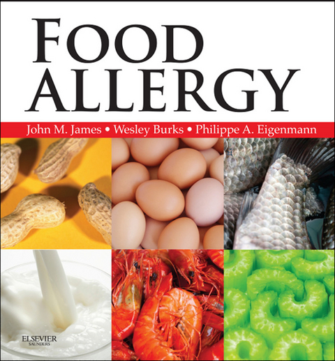 Food Allergy E-Book -  John M James,  A Wesley Burks,  Philippe Eigenmann