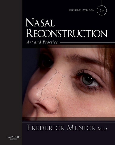 Nasal Reconstruction: Art and Practice -  Frederick J. Menick