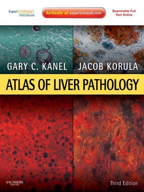 Atlas of Liver Pathology E-Book -  Gary C. Kanel,  Jacob Korula