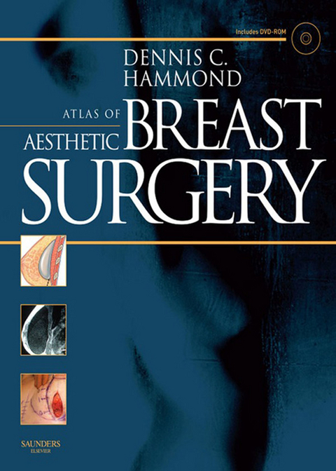 Atlas of Aesthetic Breast Surgery -  Dennis C. Hammond
