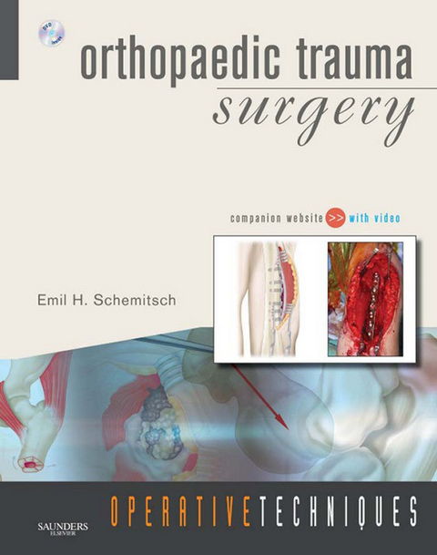Operative Techniques: Orthopaedic Trauma Surgery E-book -  Emil Schemitsch