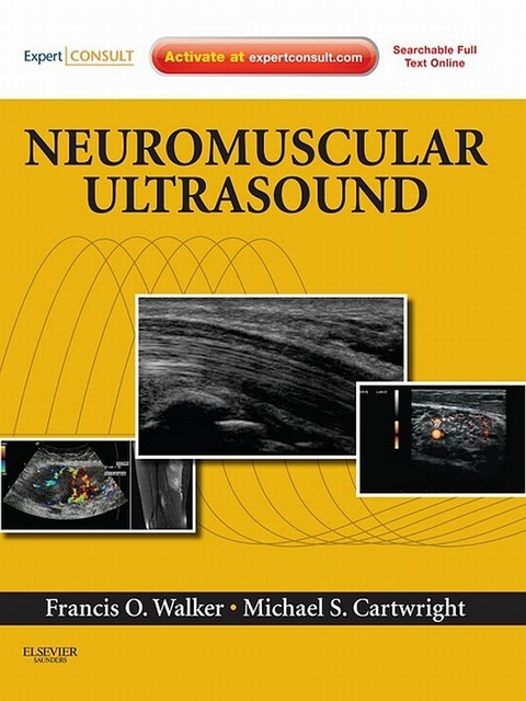 Neuromuscular Ultrasound -  Michael S. Cartwright,  Francis Walker