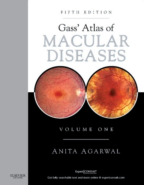 Gass' Atlas of Macular Diseases E-Book -  Anita Agarwal