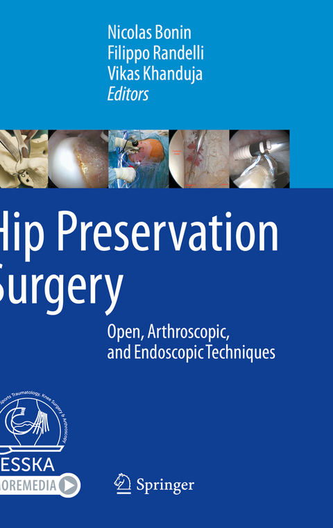 Hip Preservation Surgery - 