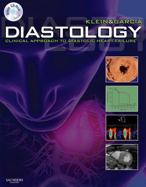 Diastology E-Book -  Allan L. Klein,  Mario J. Garcia