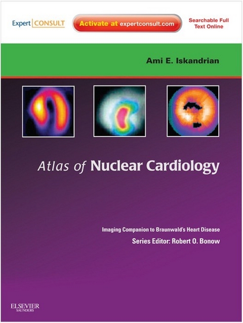 Atlas of Nuclear Cardiology: Imaging Companion to Braunwald's Heart Disease -  Ernest V. Garcia,  Ami E. Iskandrian