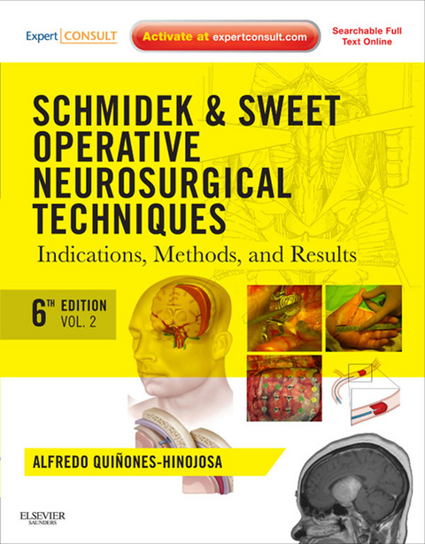 Schmidek and Sweet: Operative Neurosurgical Techniques E-Book -  Alfredo Quinones-Hinojosa