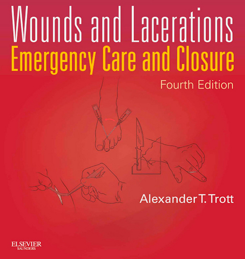 Wounds and Lacerations - E-Book -  Alexander T. Trott