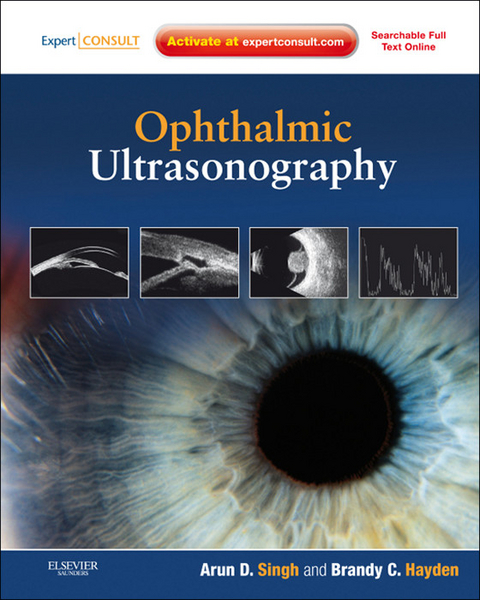 Ophthalmic Ultrasonography -  Arun D. Singh,  Brandy C. Hayden Lorek
