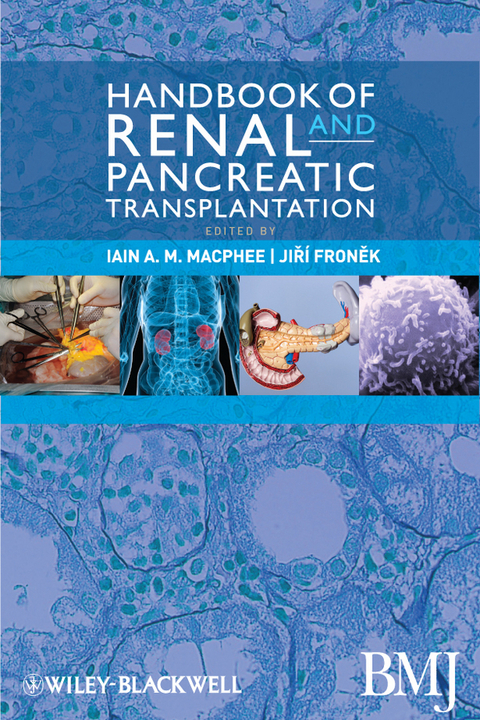 Handbook of Renal and Pancreatic Transplantation - 