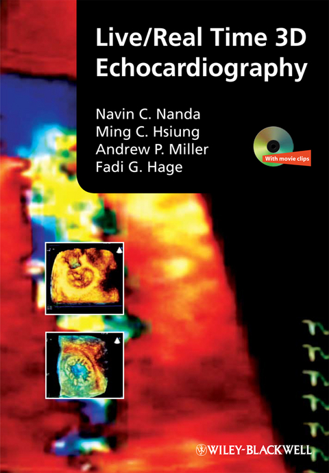 Live/Real Time 3D Echocardiography -  Fadi G. Hage,  Ming Chon Hsiung,  Andrew P. Miller,  Navin Nanda