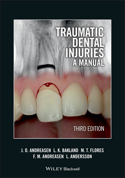 Traumatic Dental Injuries -  Lars Andersson,  Frances M. Andreasen,  Jens O. Andreasen,  Leif K. Bakland,  Maria Teresa Flores