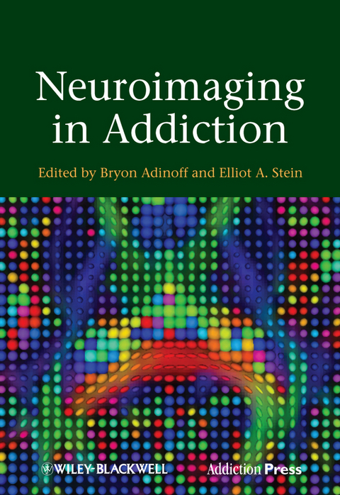 Neuroimaging in Addiction - 