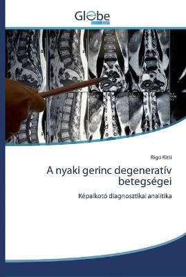 A nyaki gerinc degeneratív betegségei - Rigó Kitti