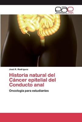 Historia natural del Cáncer epitelial del Conducto anal - José R Rodriguez