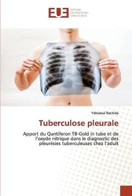 Tuberculose pleurale - Yahiaoui Rachida
