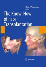 Know-How of Face Transplantation - 