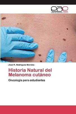 Historia Natural del Melanoma cutáneo - José R Rodriguez Morales