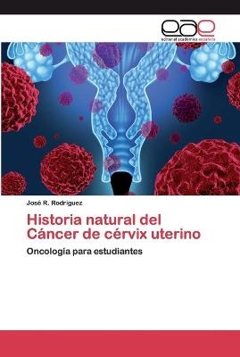 Historia natural del Cáncer de cérvix uterino - José R Rodriguez