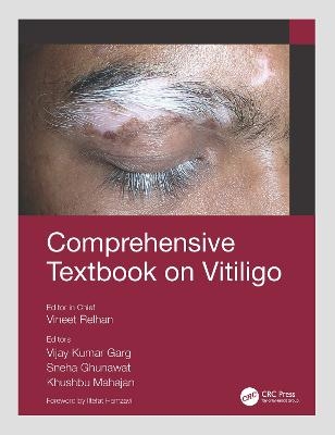 Comprehensive Textbook on Vitiligo - 