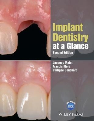 Implant Dentistry at a Glance - Jacques Malet, Francis Mora, Philippe Bouchard