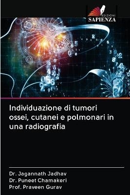 Individuazione di tumori ossei, cutanei e polmonari in una radiografia - Dr Jagannath Jadhav, Dr Puneet Chamakeri, Prof Praveen Gurav