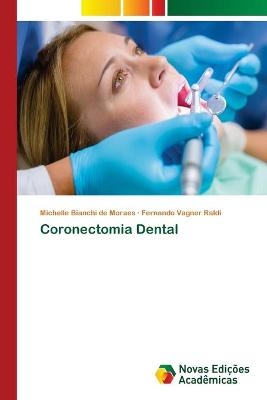 Coronectomia Dental - Michelle Bianchi de Moraes, Fernando Vagner Raldi