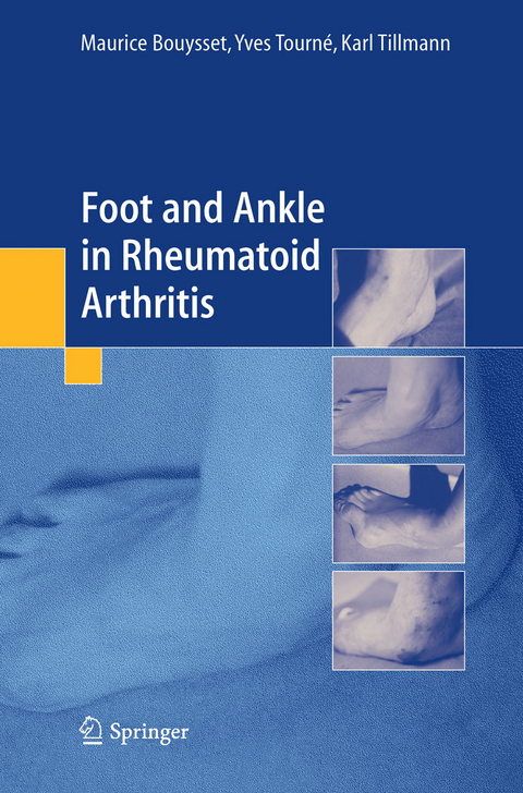 Foot and ankle in rheumatoid arthritis -  Maurice Bouysset,  Karl Tillmann,  Yves Tourne