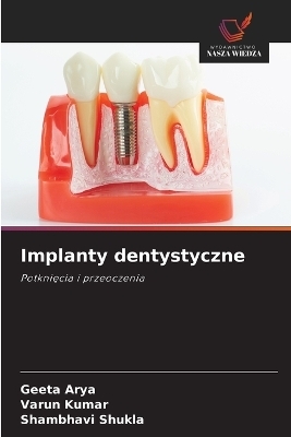 Implanty dentystyczne - Geeta Arya, Varun Kumar, Shambhavi Shukla