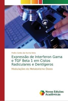 Expressão de Interferon Gama e TGF Beta 1 em Cistos Radiculares e Dentígeros - Pedro Carlos da Rocha Neto