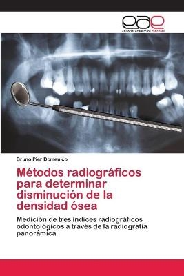 Métodos radiográficos para determinar disminución de la densidad ósea - Bruno Pier Domenico