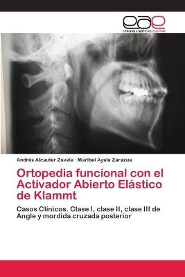 Ortopedia funcional con el Activador Abierto Elástico de Klammt - Andrés Alcauter Zavala, Maribel Ayala Zarazua